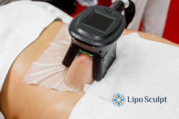 Does Fat Freezing at Home Work? DIY Devices vs Professional Cryolipolysis 1 How is professional cryolipolysis different West Tilbury?
