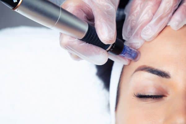 Explaining Total Skin Tightening Treatment and What to Expect 2 What Skin Concerns Can Total Skin Tightening Treatment Help With West Tilbury?